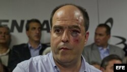 Chavistas golpean a diputados opositores en el Parlamento