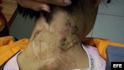 Joven esclavizada en México que escapó de sus captores